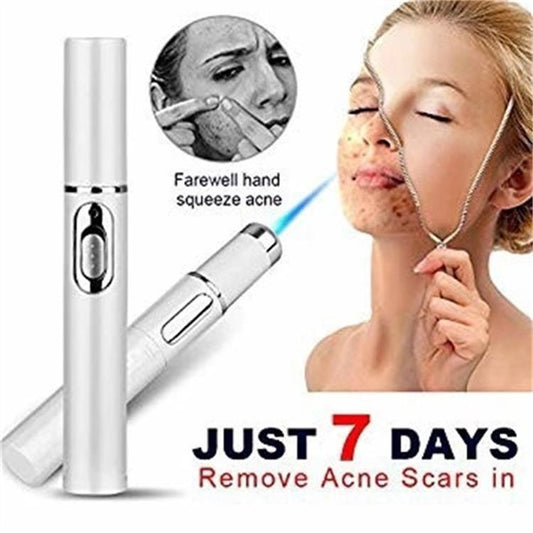 Blue Light Therapy Acne Laser Pen-0