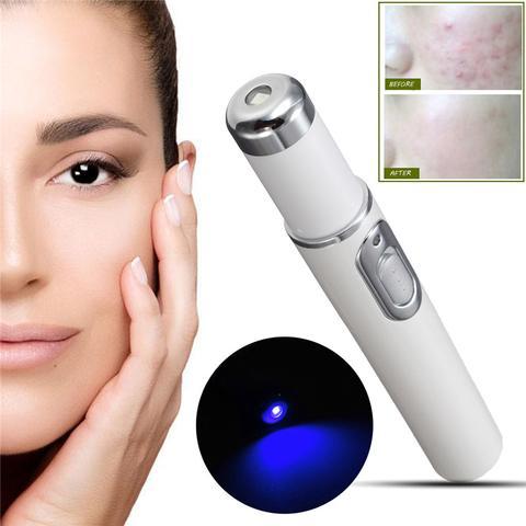 Blue Light Therapy Acne Laser Pen-1