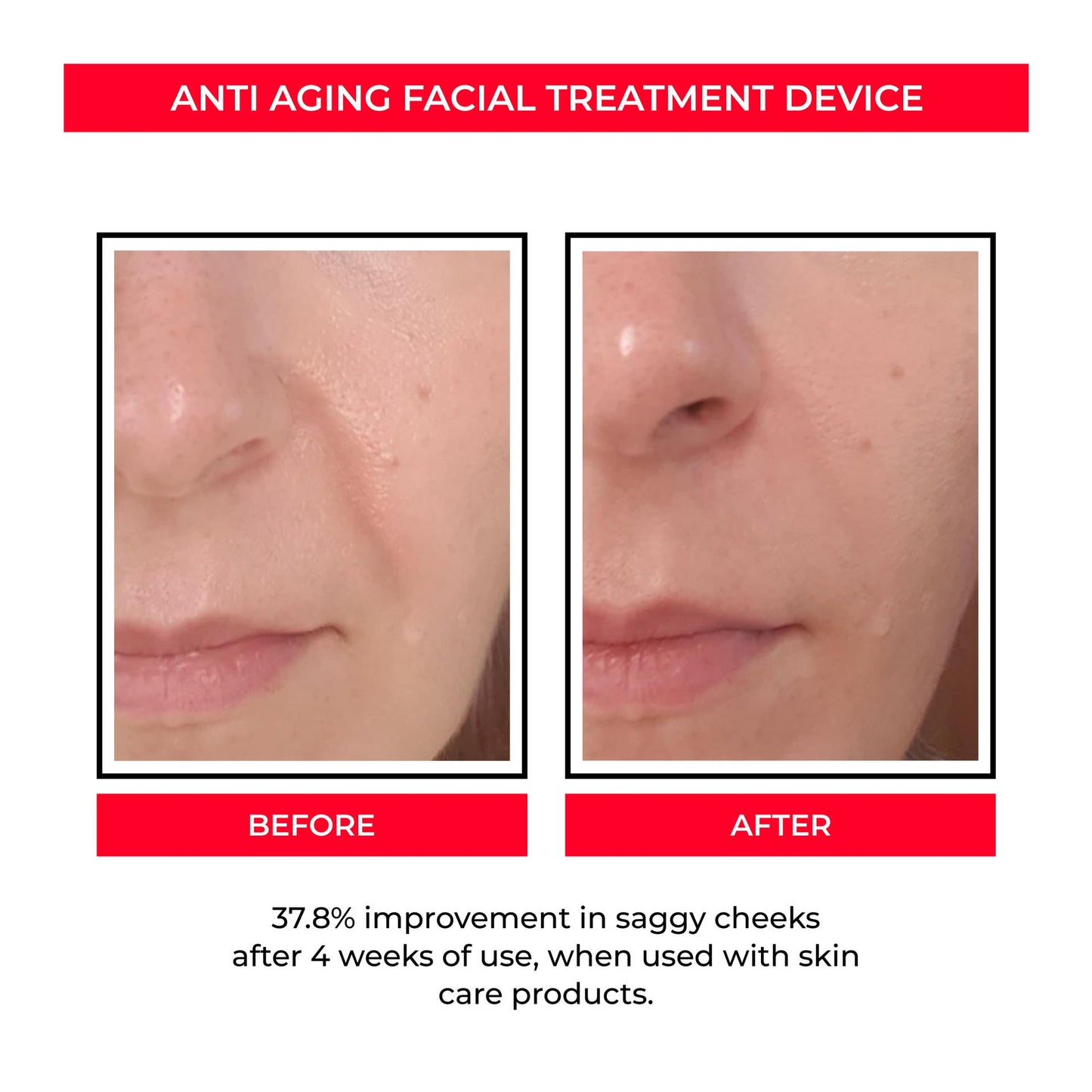 EMS Microcurrent Skin Rejuvenation Device