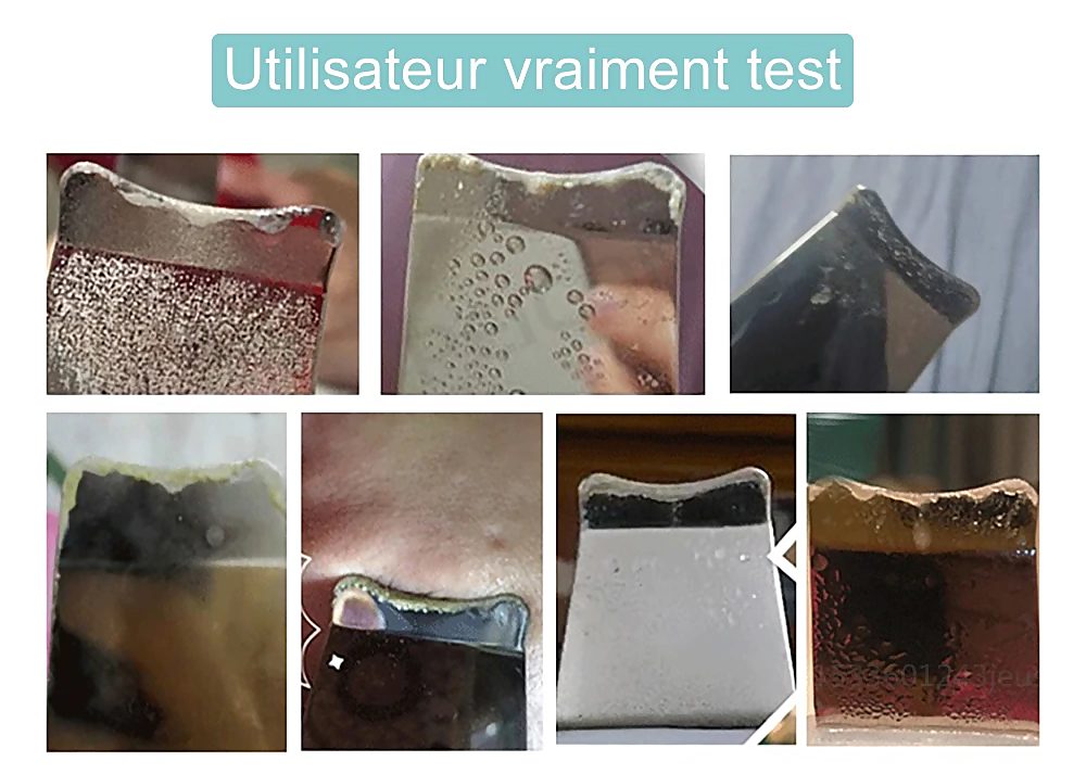STELLAR - Exfoliant Lifting EMS  5 fonctions  - Soin à ultrasons & photons