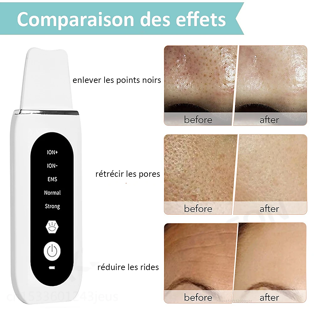 STELLAR - Exfoliant Lifting EMS  5 fonctions  - Soin à ultrasons & photons